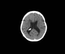 Real CT brain scan — QuadGAN input