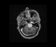 Real MRI brain scan — QuadGAN output